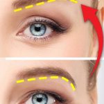 چه تفاوتی بین لیفت شقیقه و لیفت ابرو وجود دارد؟