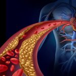 دستاورد محققان:‌ ژن‌درمانی با کریسپر کلسترول را ۵۰ درصد کاهش داد