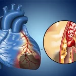 هوش مصنوعی ECG از روش‌های معمول در تیراژ روی‌گرفت رگ قلب پیشی می‌گیرد